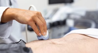 Ultrasound diagnosis of the stomach on the abdominal cavity of a man in the clinic, close-up view. The doctor runs an ultrasound sensor over the patient's male abdomen. Diagnostics of internal organs.