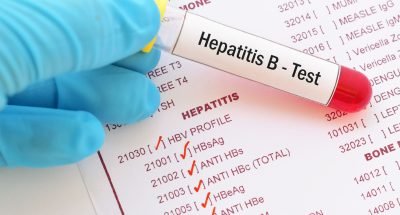 Hepatitis-B-Profile-Blood-Test-scaled
