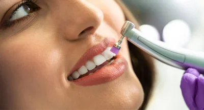 How-to-Tell-If-You-Need-Teeth-Scaling-and-Polishing