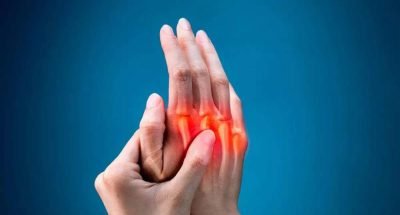 arthritis