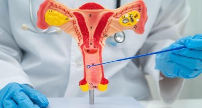doctor-holding-uterus-model-for-vaginal-and-cervix-pap-smear-check-up-in-obstetrics-gynecology-photo