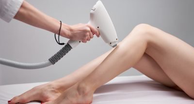 full-body-laser-hair-removal