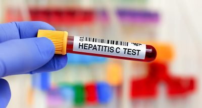 hepatitis-c-testing-thumbnail