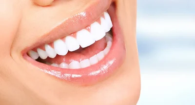 hollywood-smile-cost-in-turkey-2025