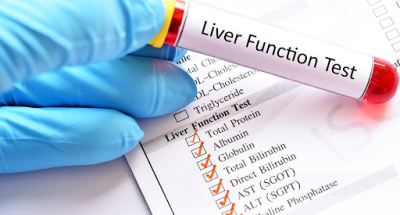 liver-function-tests-purpose-and-procedure
