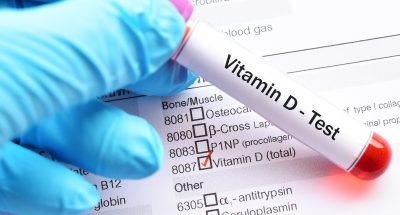 vitamin-d-test-lab-order
