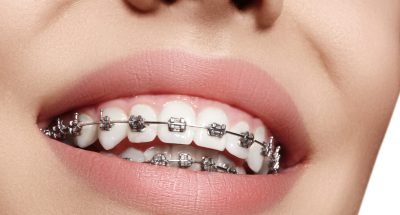 what-does-an-orthodontist-do